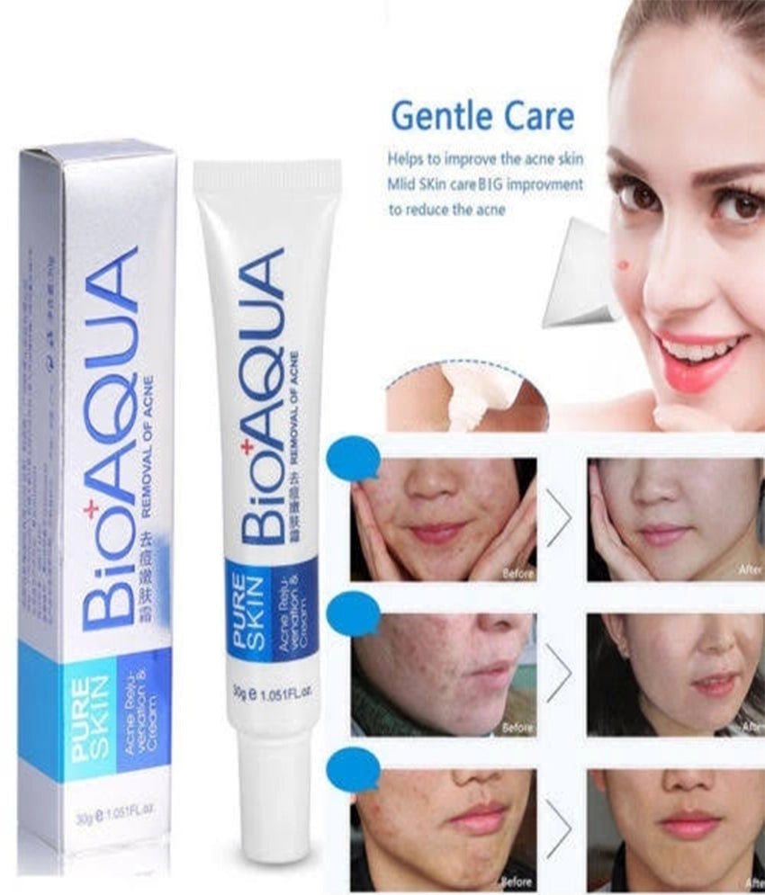 BIOAQUA Face Skin Care Acne Anti-Wrinkle Removal Cream