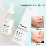 The Ordinary – Niacinamide 10% + Zinc 1% 30 ML